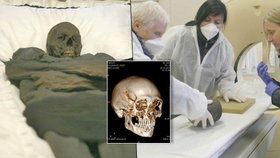 Mumie na rentgenu: Baron Trenck vydal po 270 letech své tajemství! Válečníka nepostřelili