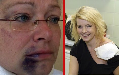Iveta i Darina byli ve společnosti Rychtáře podezřele zraněné...