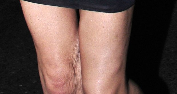 Victoria Beckham už nemá tak sexy nohy díky hubnutí