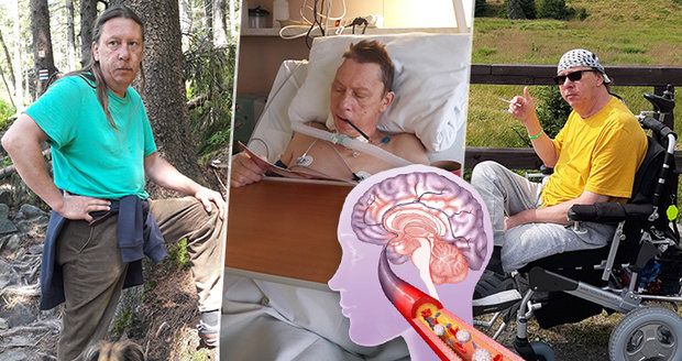 Mrtvice ho uvěznila ve vlastním těle. „Nejhorší chvíle života,“ vzpomíná Bedřich (54)