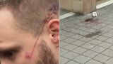 Cizinci v Brně pobodali a pořezali dva muže. Policie je dopadla a obvinila