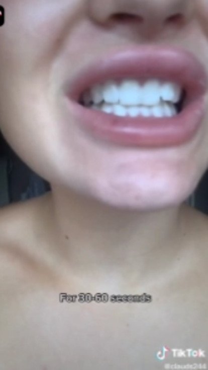 Nový nebezpečný trend z TikToku: Bělení zubů peroxidem vodíku.