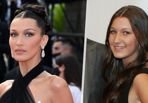 Bella Hadid ve čtrnácti podstoupila plastiku nosu