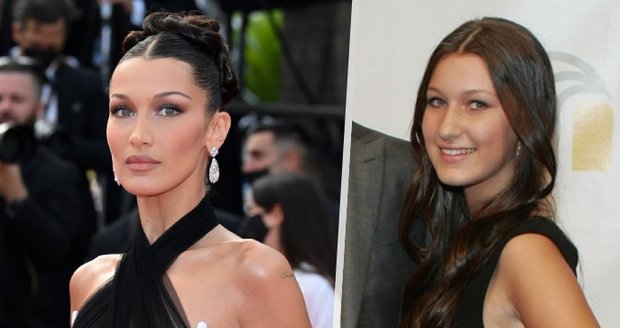 Bella Hadid ve čtrnácti podstoupila plastiku nosu