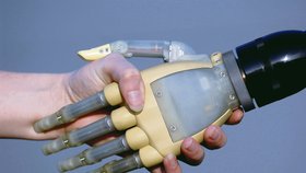 Bionická ruka je řízena přímo mozkem a umí i jem-nou motoriku