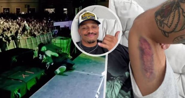 Ben Cristovao se zřítil z podia