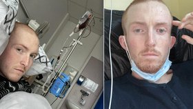 Benovi (22) diagnostikovali angínu místo leukémie. Báli se mu pořádně podívat do krku kvůli covidu.