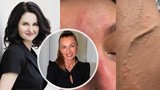 Osypaná influencerka Bendová: Hazard a za bludy ostrá kritika! Vývojářka kosmetiky promluvila pro Blesk