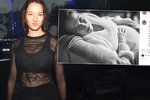Těhotná Berenika Kohoutová přiznala: Mám deprese a stala jsem se závislou na...