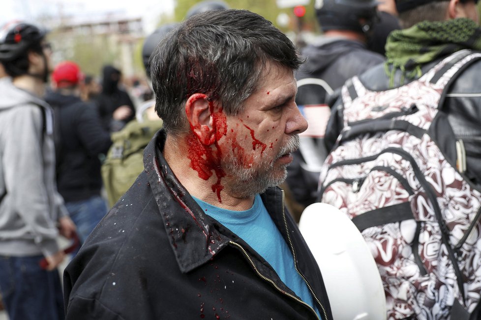 V kalifornském Berkeley tekla krev: Střetli se odpůrci a fanoušci prezidenta Donalda Trumpa