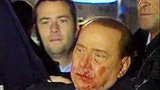 Zkrvavený Berlusconi: Útočníka obvinili z těžkého ublížení!