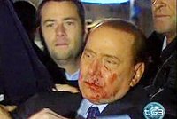 Potlučený Berlusconi vzkazuje: Láska zvítězí!
