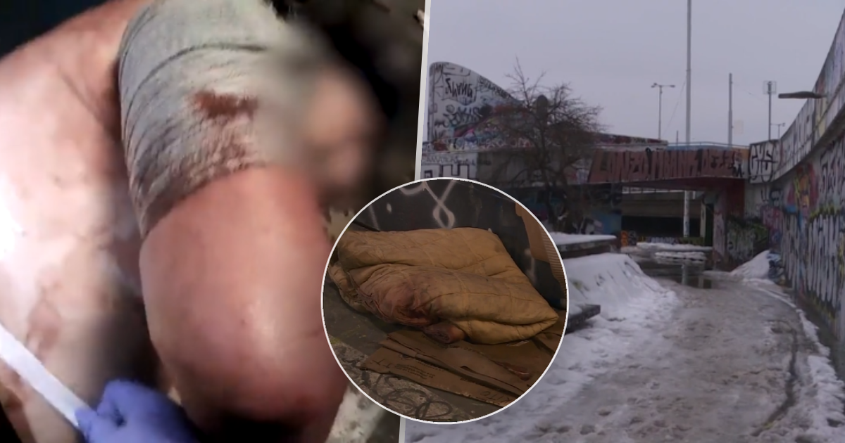 Hombre gravemente herido en Praga: ¡¿Lo apuñaló un niño (16)?!