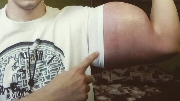 Je mu 21 let a kvůli touze po velkých svalech hazarduje se životem. Je mu 21 let a kvůli touze po velkých svalech hazarduje se životem.