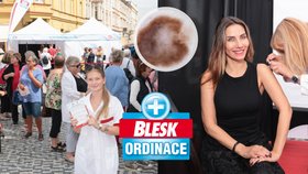 Blesk Ordinace v Hradci Králové vyšetřila 2 434 návštěvníků a odhalila 6 nádorů kůže.