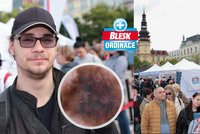 Olegovi (22) Blesk Ordinace zachránila život: Nejagresivnější nádor kůže! A žena v ohrožení odmítla sanitku