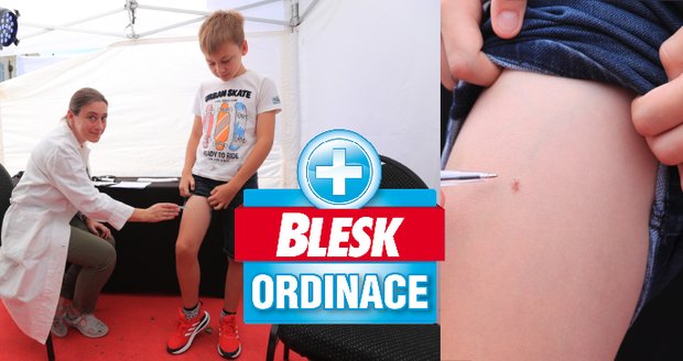 Blesk Ordinace v Pardubicích ukázala: 18 podezřelých nálezů! Hlídejte znaménka i dětem, varuje lékařka