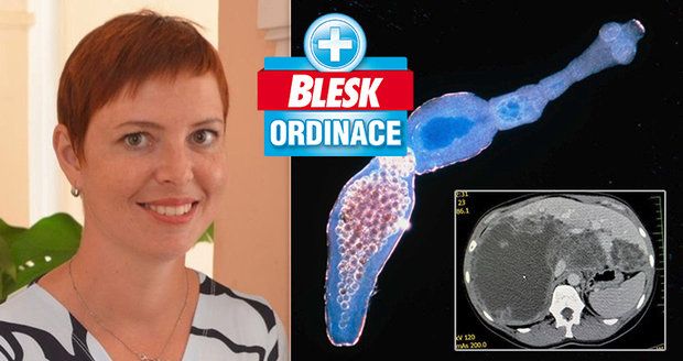 Vendula (36) snědla borůvky a parazit jí zlikvidoval játra! Tasemnice „pracuje“ nenápadně, varuje primář