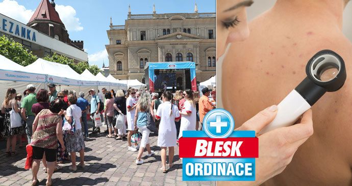 Blesk Ordinace: V Opavě odhalen největší počet nádorů kůže!