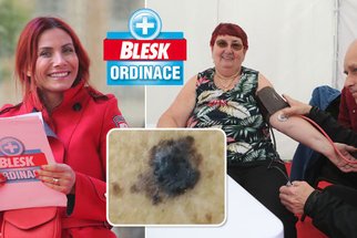 Blesk Ordinace v Hradci Králové znovu zachraňovala: Odhaleny dvě rakoviny kůže!