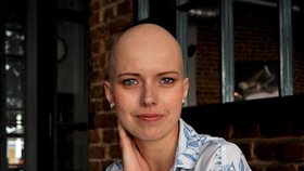 Tereza Drahoňovská napsala komiks o svém boji s alopecií. Čtenáře nadchl svojí upřímností, citlivostí a humorem.