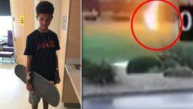 Blesk zasáhl chlapce (13). Probudil se po třech dnech, život mu zachránil skateboard