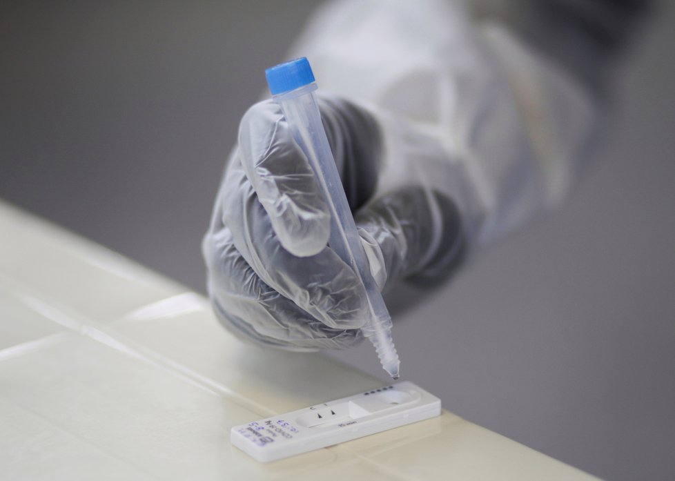 Antigenní testy získaly na oblibě i v Bolívii (12.1.2021)
