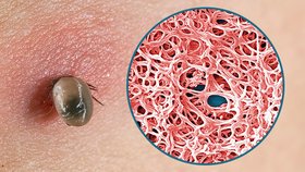 Zákeřné boreliózy v Česku letos přibylo, případů je přes 900. Lékaři radí, jak se chránit