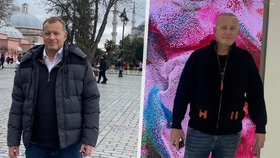 Boris Kollár si v Turecku nechal transplantovat vlasy.
