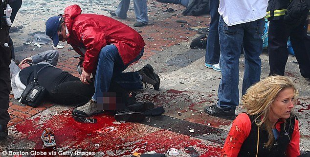 15. 4. 2013: Takhle vypadala zraněná Celeste v den atentátu. Všude byla krev.