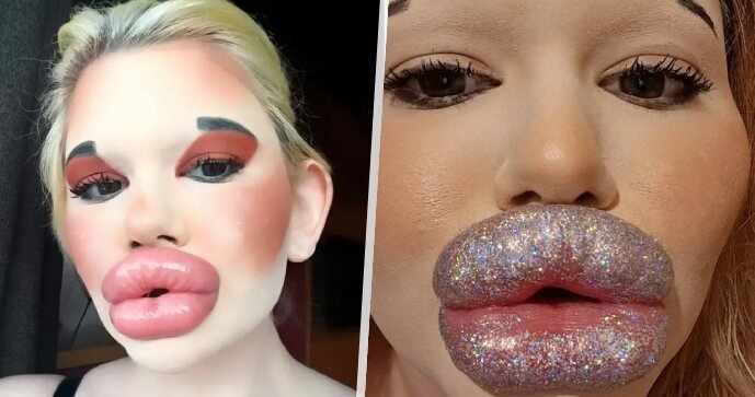 Andrea si libuje v botoxových výplních.