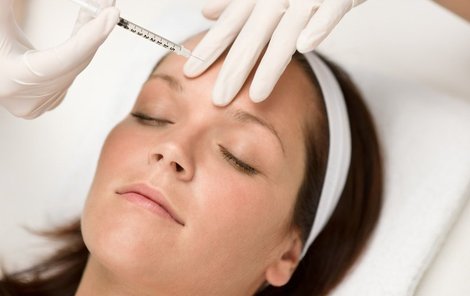 Botox je v rukou zkušených lékařů bezbolestnou procedurou.