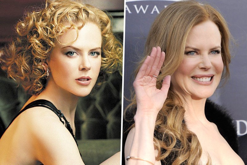 Herečka Nicole Kidman (43) po aplikaci botoxu připomíná slavného Jokera z filmu Batman.