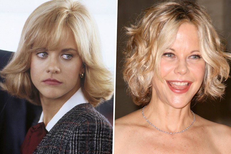 I herečka Meg Ryan (49) podstoupila celou řadu plastických operací.