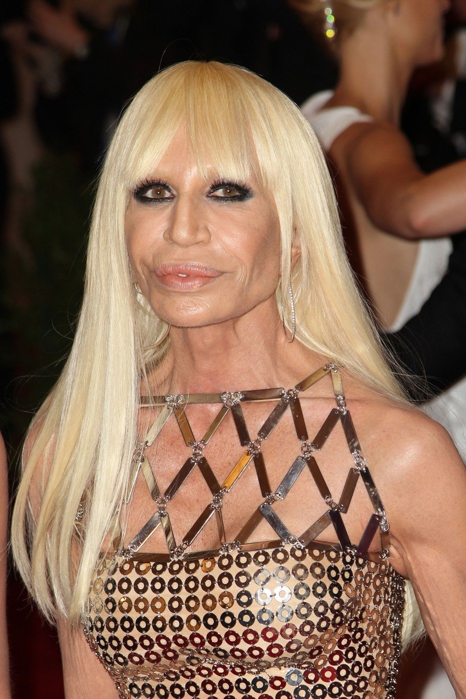 Donatella Versace je ukázkovým případem, jak může přemíra botoxu skončit.