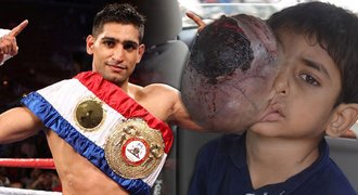 Boxer Khan vydělal půl miliardy: Záchraňuje chlapce s obřím nádorem oka!