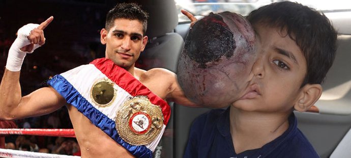 Sedmiletý Ali Hassan bojuje o život, místo pravého oka má obří nádor. Pomoci se mu rozhodl boxer Amir Khan, který v kariéře vydělal přes půl miliardy korun.