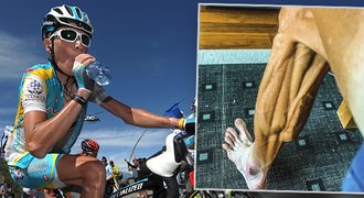 Šokoval nohama po závodě, promluvil o bulimii: V cyklistice je jí plno!