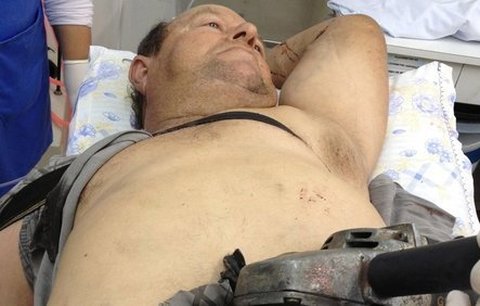 Muž (56) se odvezl do nemocnice s motorovou pilou v břiše