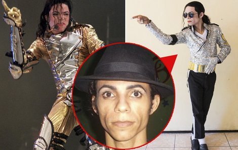 Brazilec touží vypadat jako Michael Jackson, jen za méně peněz.