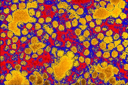 Virus žluté zimnice