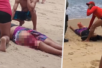 Dva brutální žraločí útoky během dvou dnů! Chlapec (14) přišel o nohu, žena o ruku
