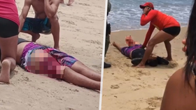 Dva brutální žraločí útoky během dvou dnů! Chlapec (14) přišel o nohu, žena o ruku.