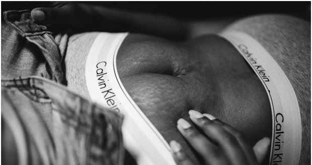 Žena fotografuje své tělo a ukazuje, jak se po porodu nestydět za strije