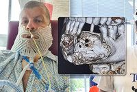 27 let nebyl u zubaře: Pak mu museli odoperovat skoro celou čelist!