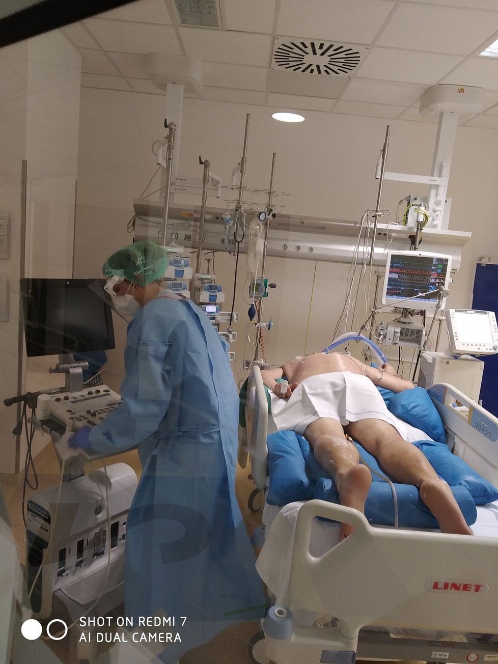 Na specializovaném ARO ve Fakultní nemocnici u sv. Anny v Brně se léčí pacienti s nějtěžším průběhem koronaviru.