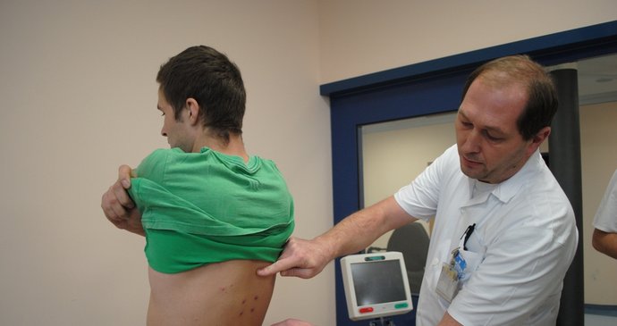 Primář Vladimír Mužík ukazuje, že po operaci zbyly pacientovi v zádech jen čtyři vpichy.