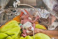 Sto dětí pod kilo a půl, inkubátory jedou v porodnici v Brně naplno: Potřebují ještě jeden