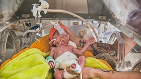 Sto dětí pod kilo a půl, inkubátory jedou v porodnici v Brně naplno: Potřebují ještě jeden