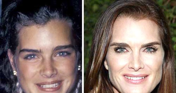 Brooke Shields (44) 1981-2009: Jako mladičká zazářila tato bývalá supermodelka a nyní herečka ve snímku Modrá laguna, který ji proslavil nejvíce. Exmanželka tenisty André Agassiho stárne přirozeně a nestydí se za to. Plastiky odmítá. Zrovna ona tvrdí, že mají v rodině dobré geny. Navíc prý nemá čas nějak pozorovat přibývající léta. Je šťastně vdaná a je maminkou dvou malých roztomilých holčiček.